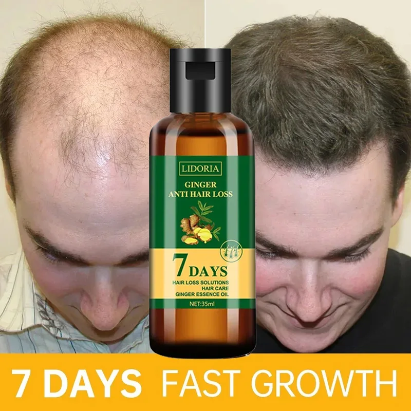 Hair Care Essential Oil Atomizing - Ginger Hair Growth olio essenziale Anti-perdita