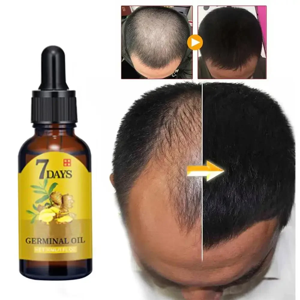 Hair Care Essential Oil Atomizing - Crescita dei capelli Zenzero Capelli a