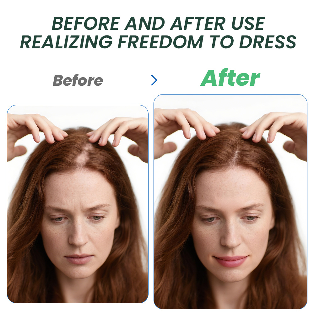 Crema per la Crescita dei Cape - Hair Care Dupes recensione e prezzo