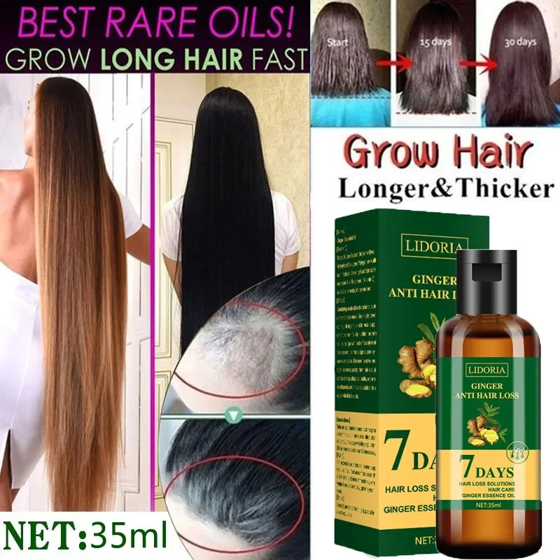 Ginger Hair Growth olio essenz - Hair Care Essential Oil Atomizing recensione e prezzo