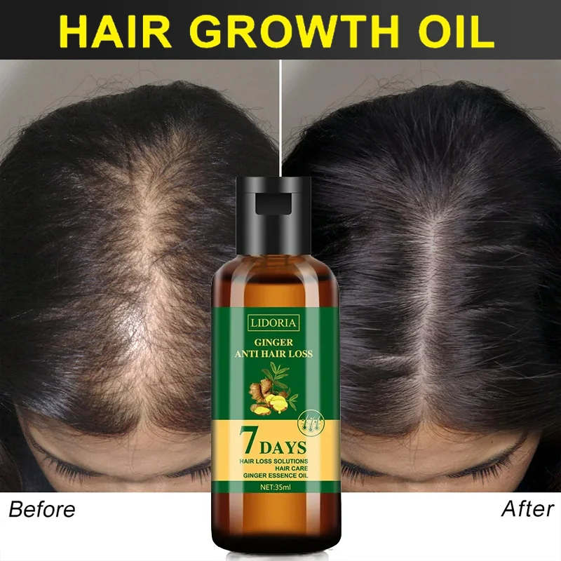Ginger Hair Growth olio essenz - Hair Care Essential Oil Atomizing recensione e prezzo