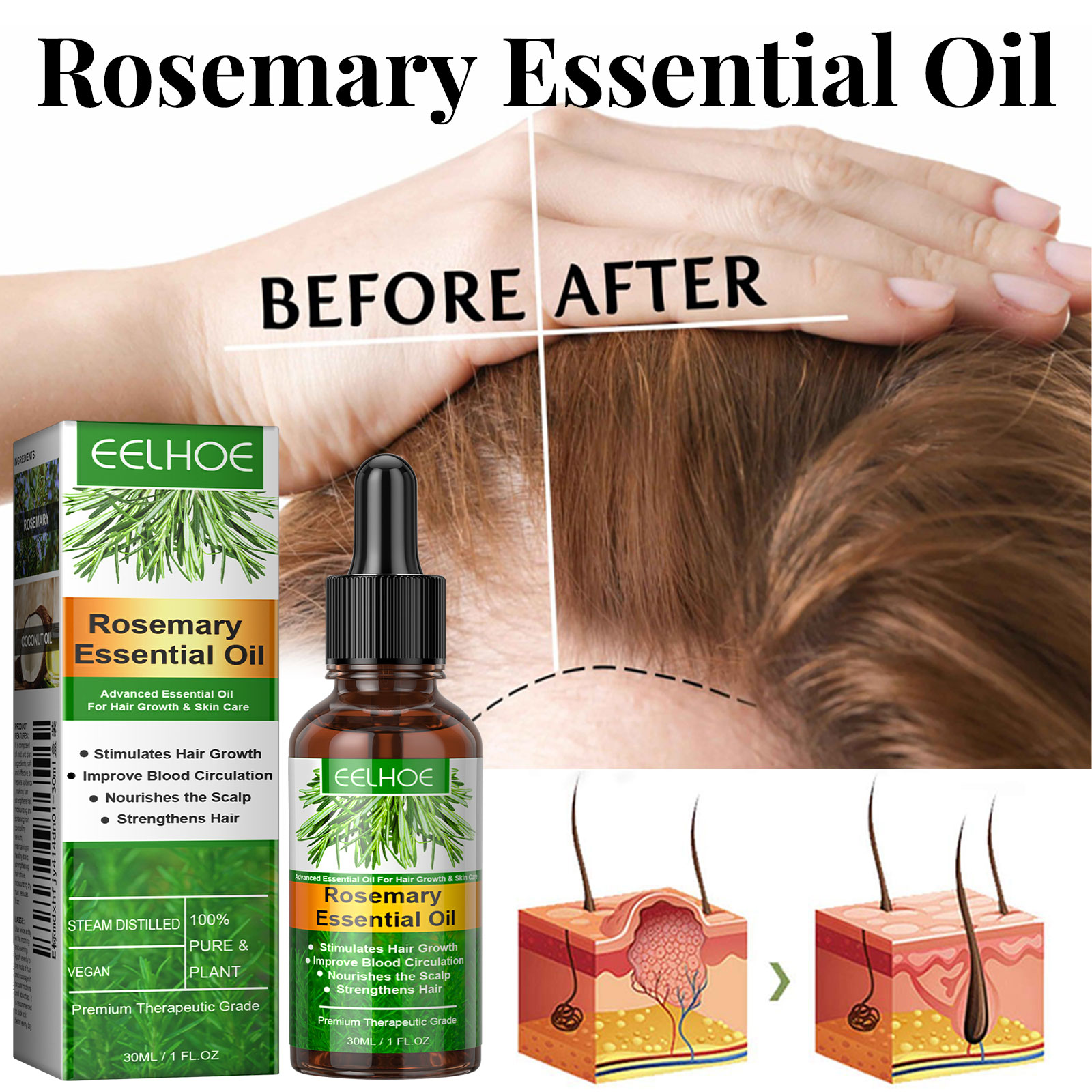 Siero per la crescita dei cape - Hair Care Essential Oil Atomizing recensione e prezzo