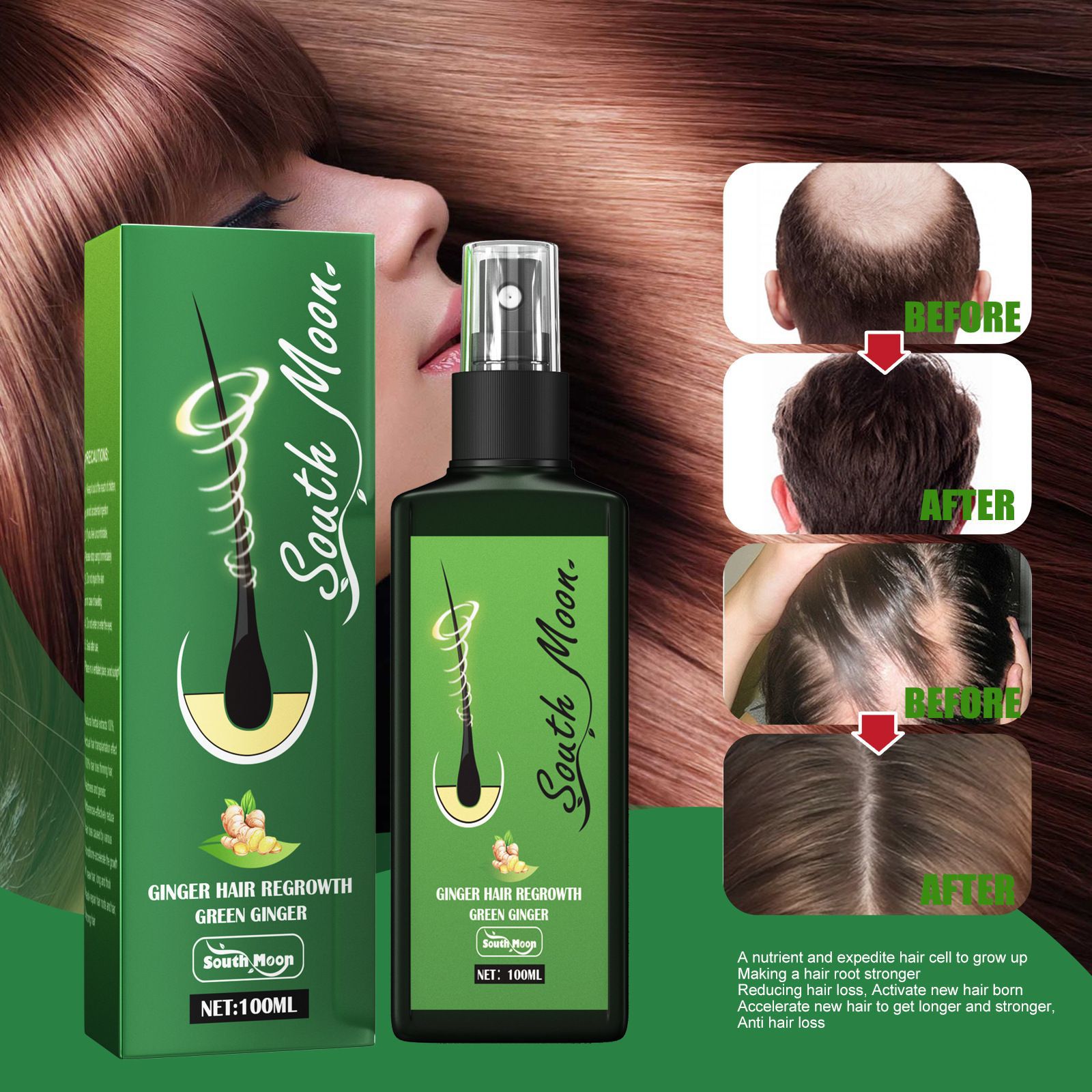 Spray per la Crescita dei Cape - Hair Care Herbal recensione e prezzo