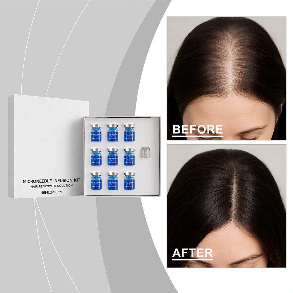Set di Micro-Aghi con Siero Es - Hair Care Oil Serum recensione e prezzo