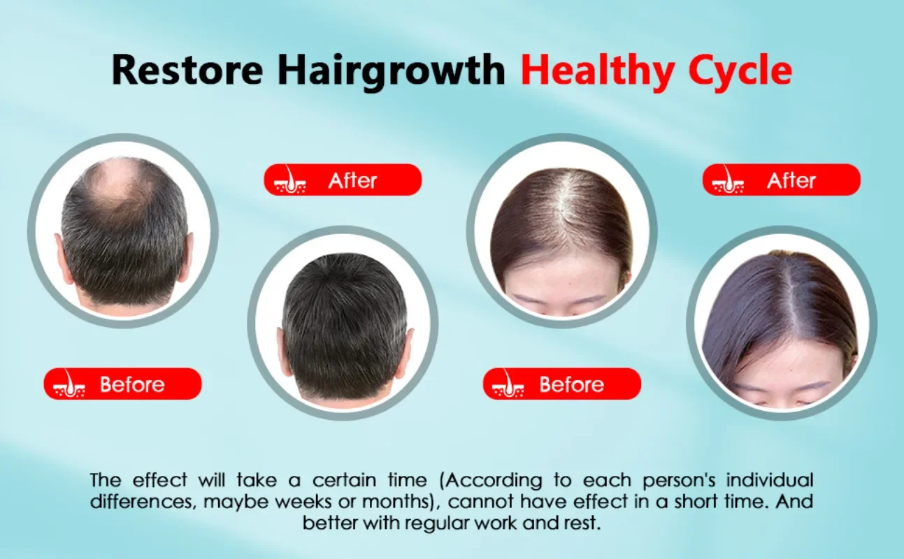 Cuffia per la crescita dei cap - Hair Care Vegan recensione e prezzo