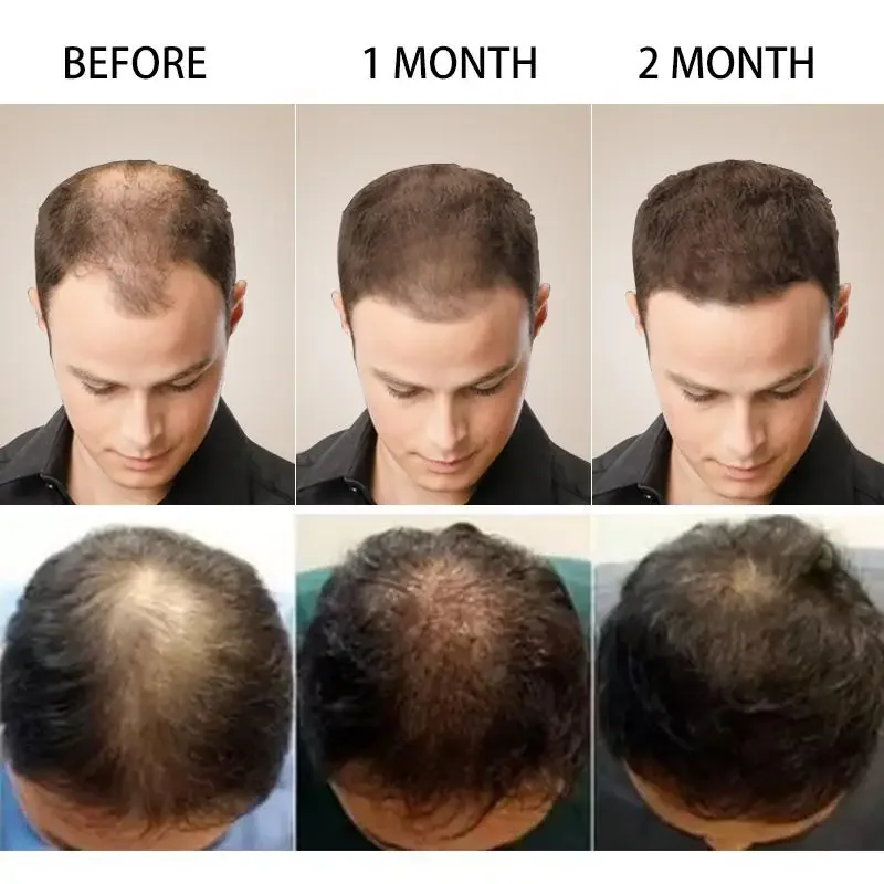 Crescita dei capelli Zenzero C - Hair Care Essential Oil Atomizing recensione e prezzo