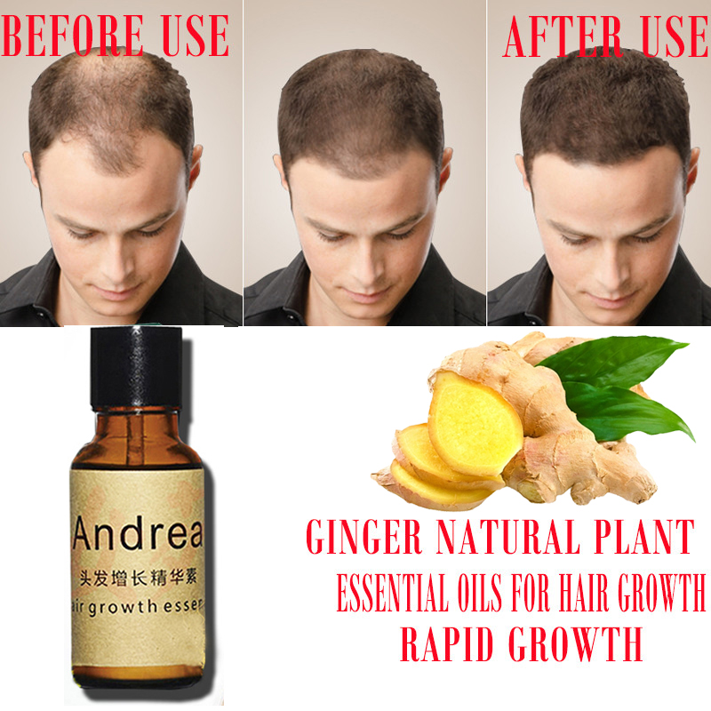 2/5/10 Pz Andrea Crescita Dei  - Hair Care Herbal recensione e prezzo