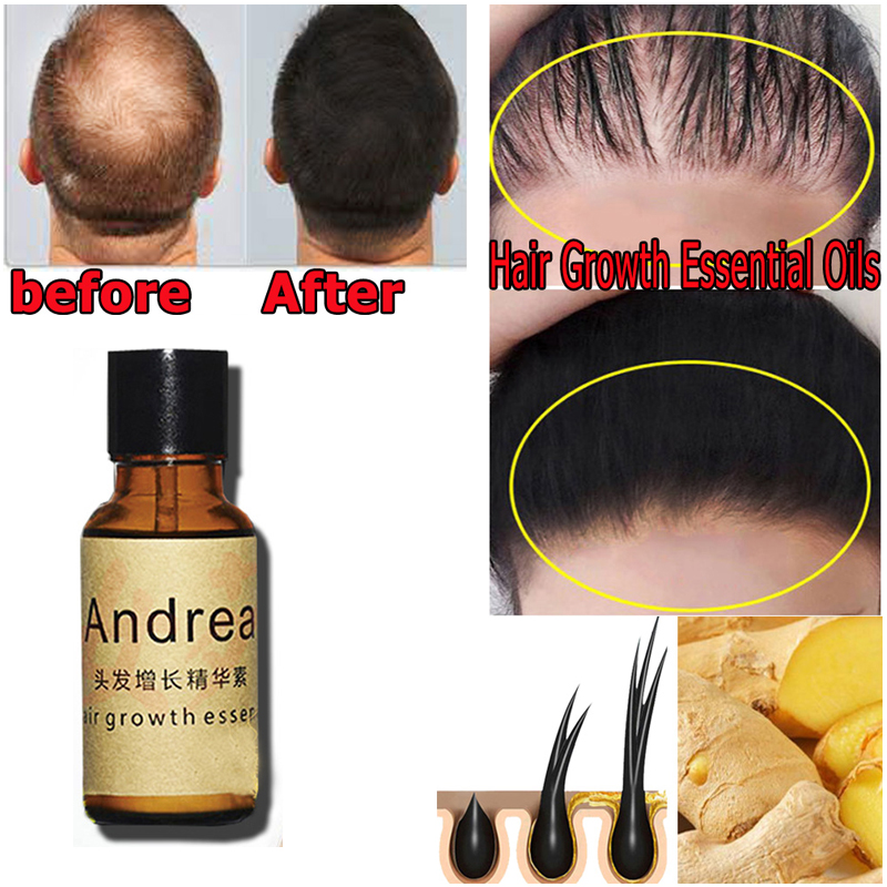 2/5/10 Pz Andrea Crescita Dei  - Hair Care Herbal recensione e prezzo